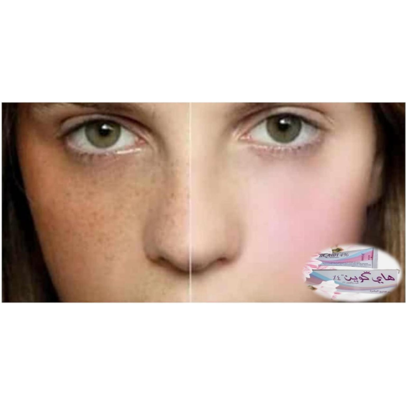 proimg/108765/4.jpg